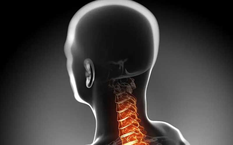 دلایل دیسک گردن در نوجوانی