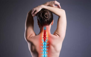 علائم دیسک گردن خفیف و راهکارهای مدیریت آن