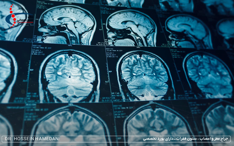 mri چيست