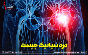 درد سیاتیک چیست
