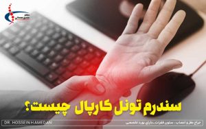 سندرم تونل کارپال چیست؟ علائم، علت و راه های درمان و تشخیص آن