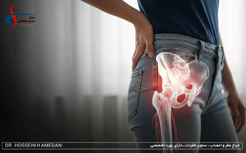 درد سیاتیک چقدر طول میکشد