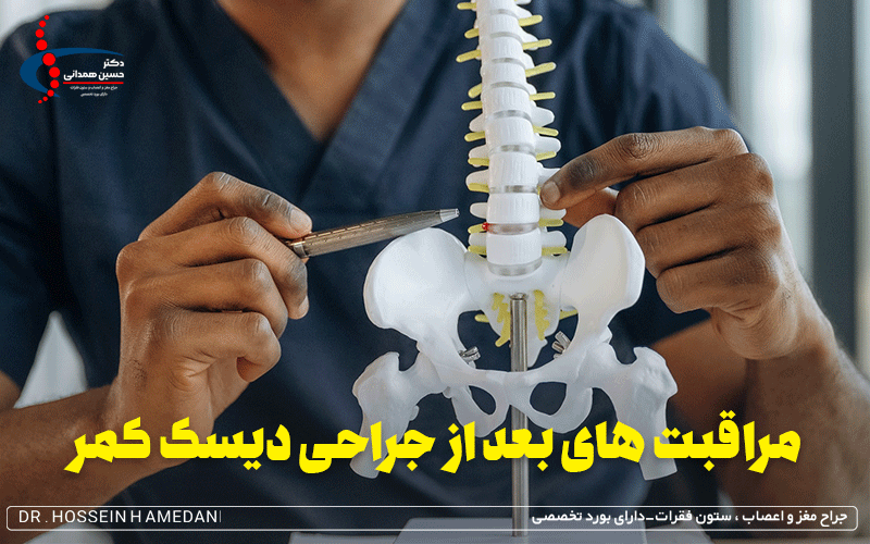مراقبت های بعد از جراحی دیسک کمر