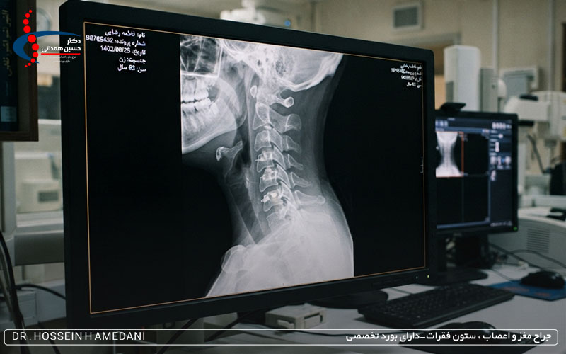 راه های پیشگیری از مشکلات ستون فقرات