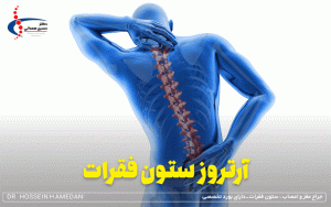 آرتروز ستون فقرات