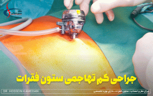 جراحی کم تهاجمی ستون فقرات چیست